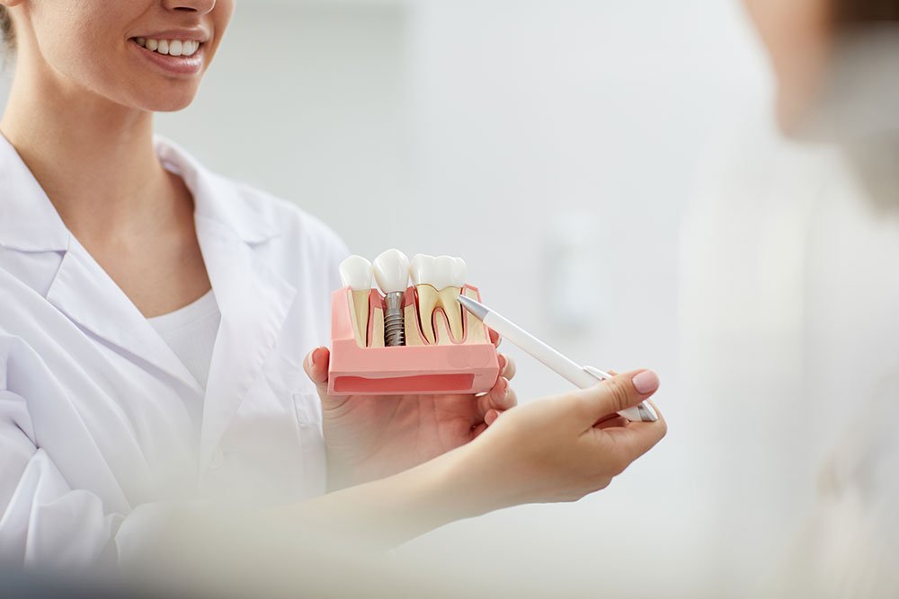 dental implant griffith